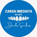 Carga Imediata